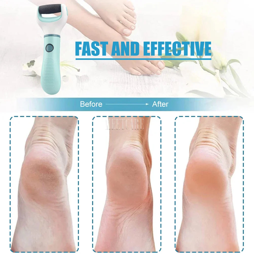 Electric Foot Grinder Callus Remover Tool