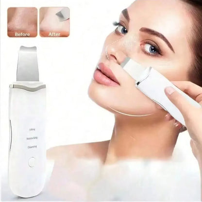 Blackhead Remover Vacuum Acne Pore Cleaner
