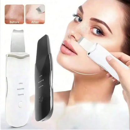 Blackhead Remover Vacuum Acne Pore Cleaner