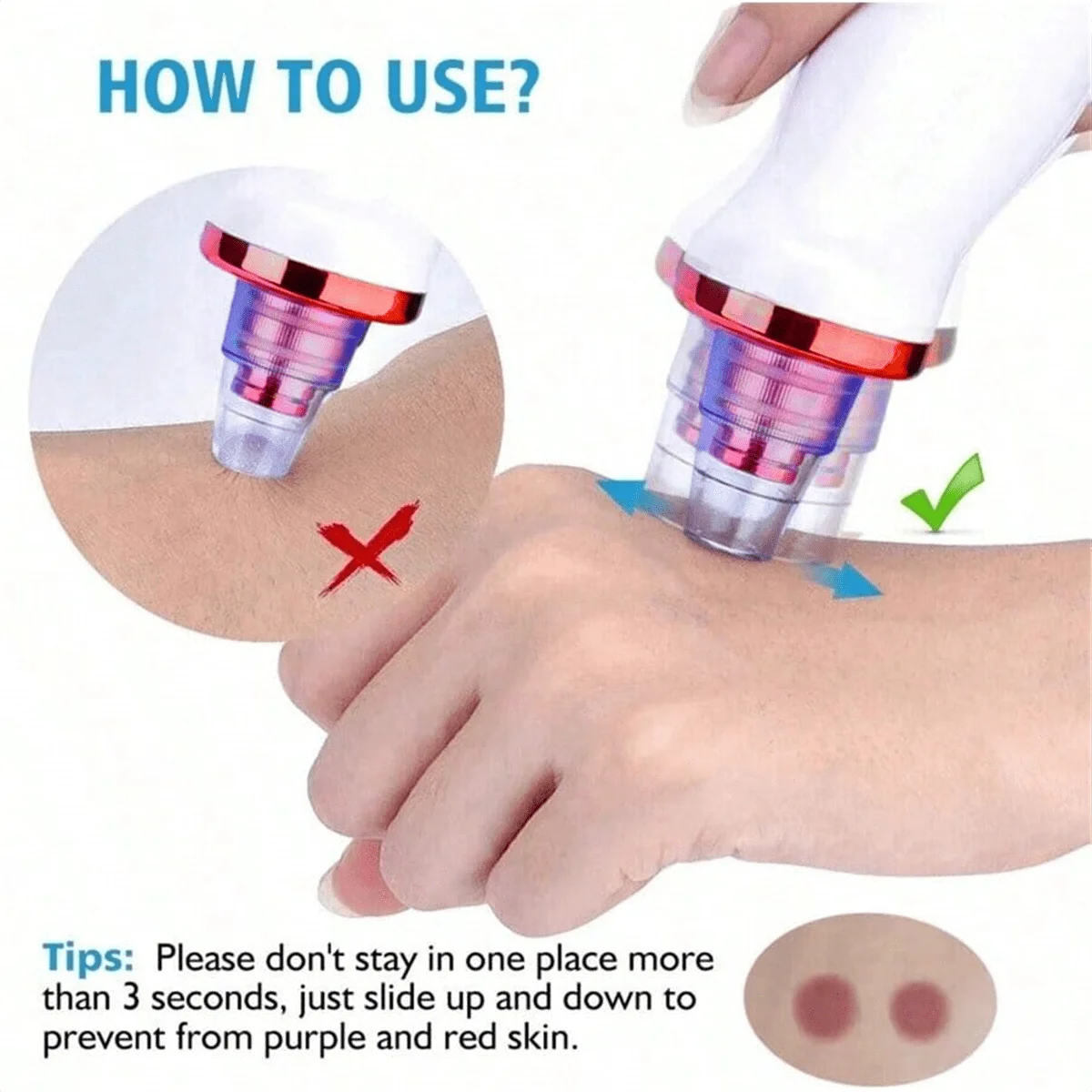 Blackhead Remover Vacuum Acne Pore Cleaner