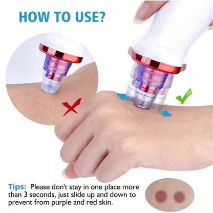 Blackhead Remover Vacuum Acne Pore Cleaner
